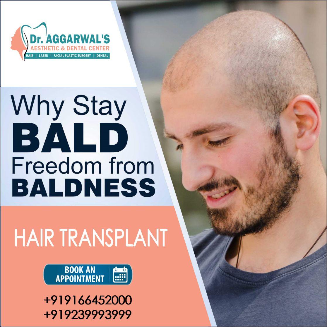 HAIR TRANSPLANT_compressed HAIR TRANSPLANT
