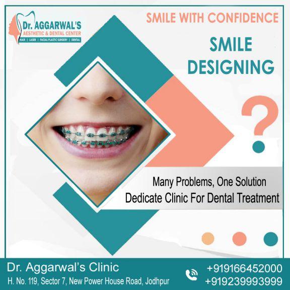 dental invisble braces_compressed DENTAL TREATMENT Banner At Dr Aggarwals