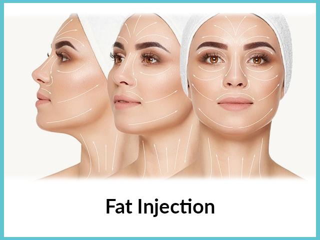 fat injection fat injection