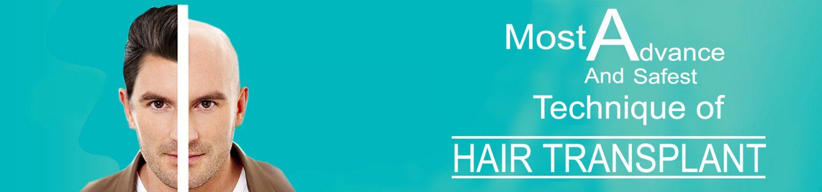FUE HAIR TRANSPLANT 1 2 copy