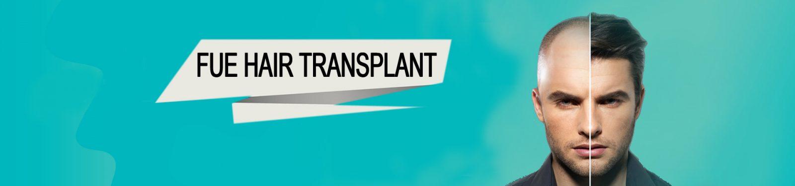 FUE HAIR TRANSPLANT 1