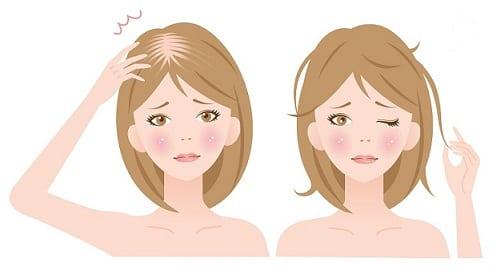 hairlossfemalecartoonimage hairlossfemalecartoonimage