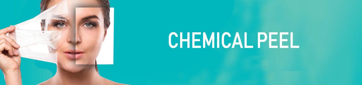 CHEMICAL-PEEL-1536x360