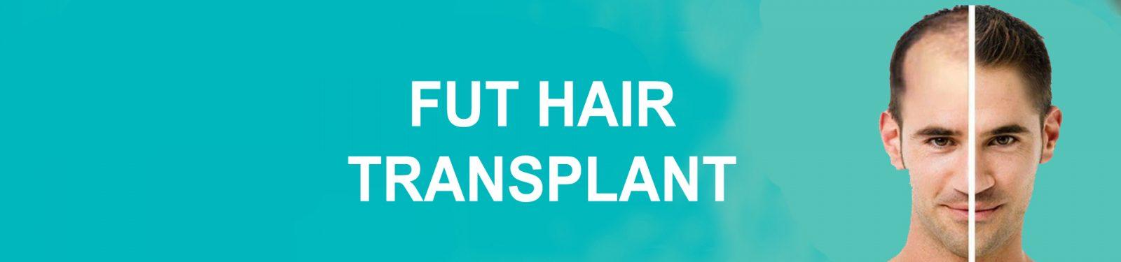 FUT HAIR TRANSPLANT 1 2 copy