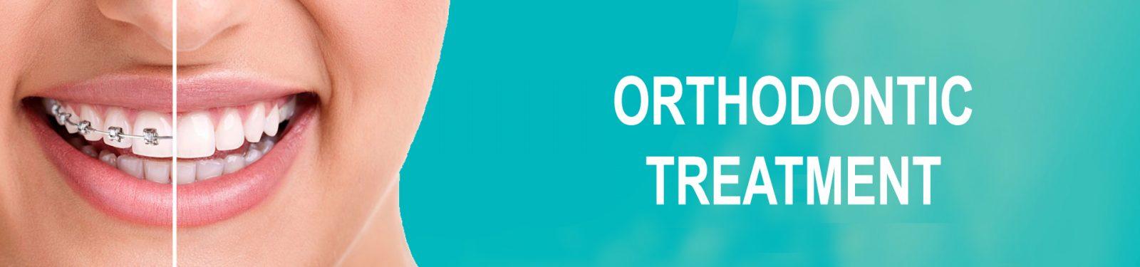 ORTHODONTIC TEATMENT