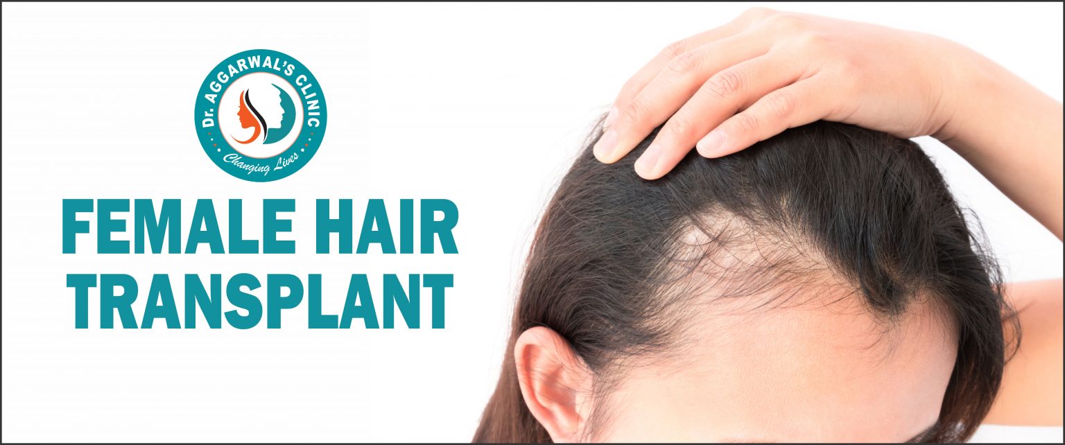 Female Hair Transplant in jodhpur DrAggarwalsClinic